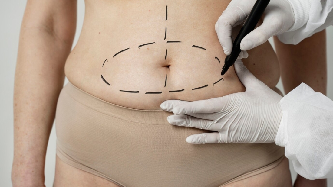 front-view-woman-with-marker-traces-belly_23-2149349968