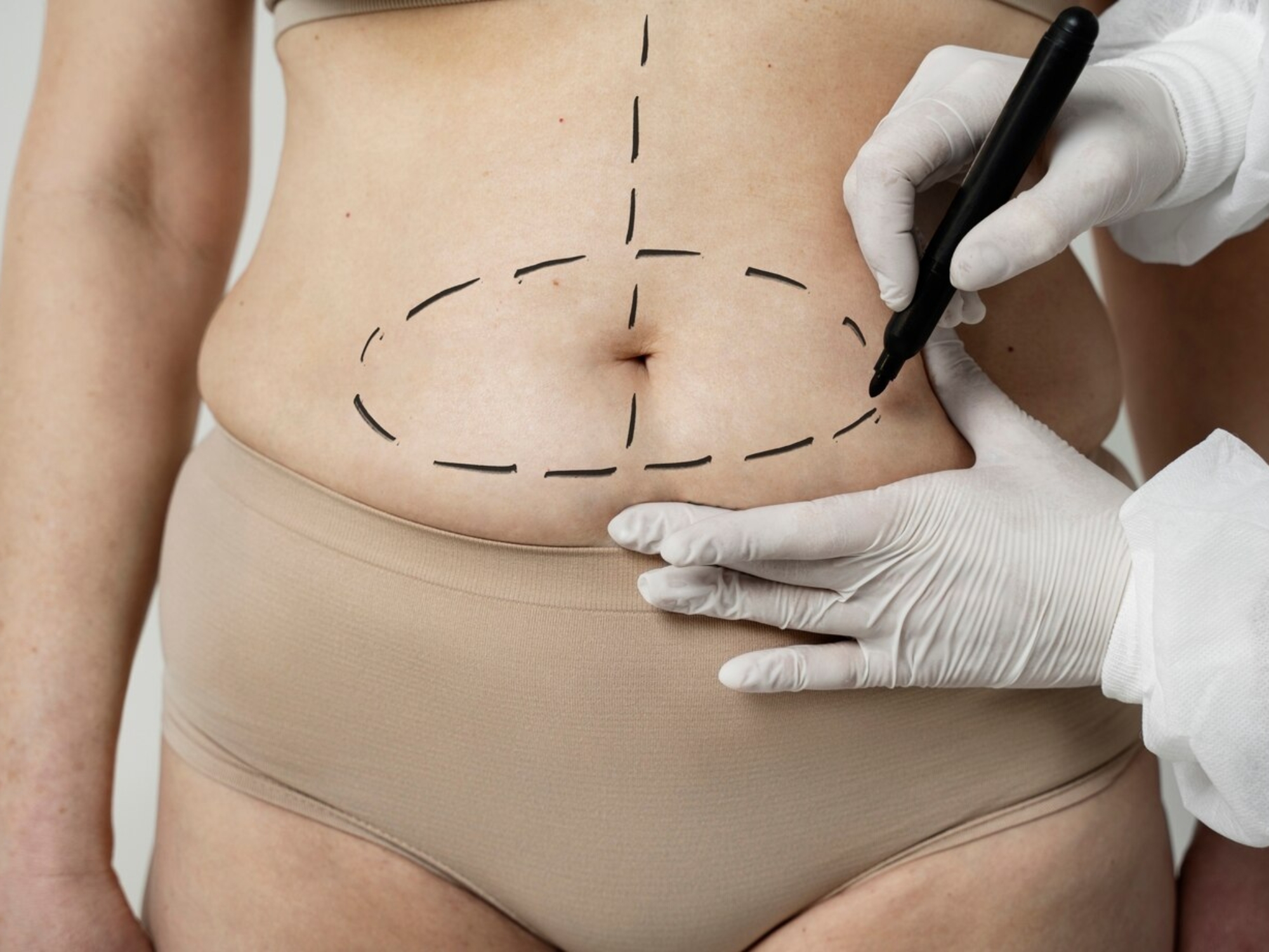 front-view-woman-with-marker-traces-belly_23-2149349968
