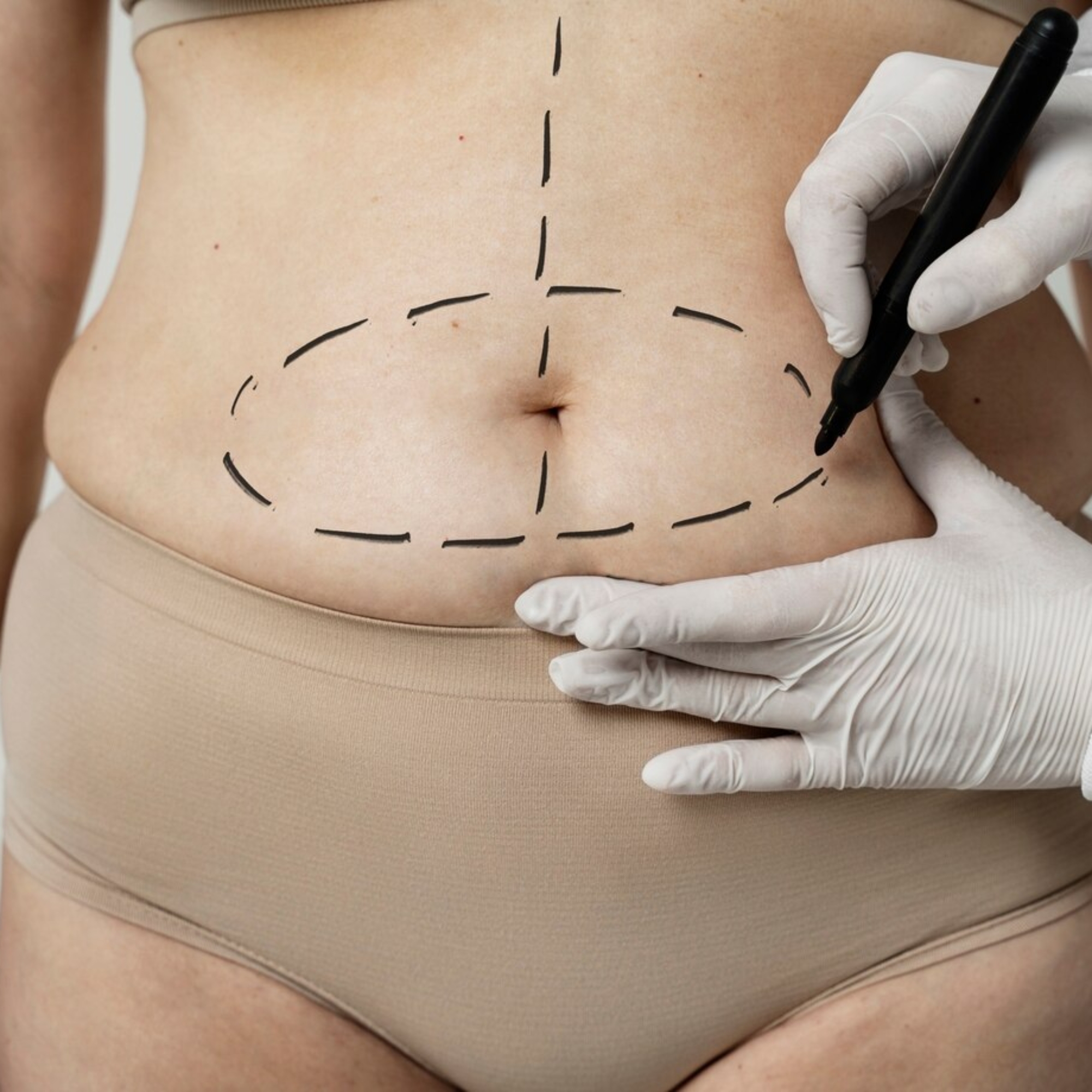 front-view-woman-with-marker-traces-belly_23-2149349968