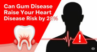 Can Gum Disease Raise Your Heart Disease Risk by 28%?—What Science Says