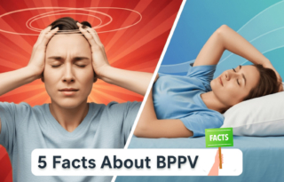BPPV