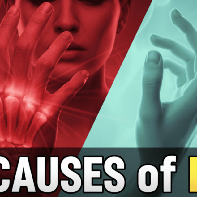 Rheumatoid Arthritis