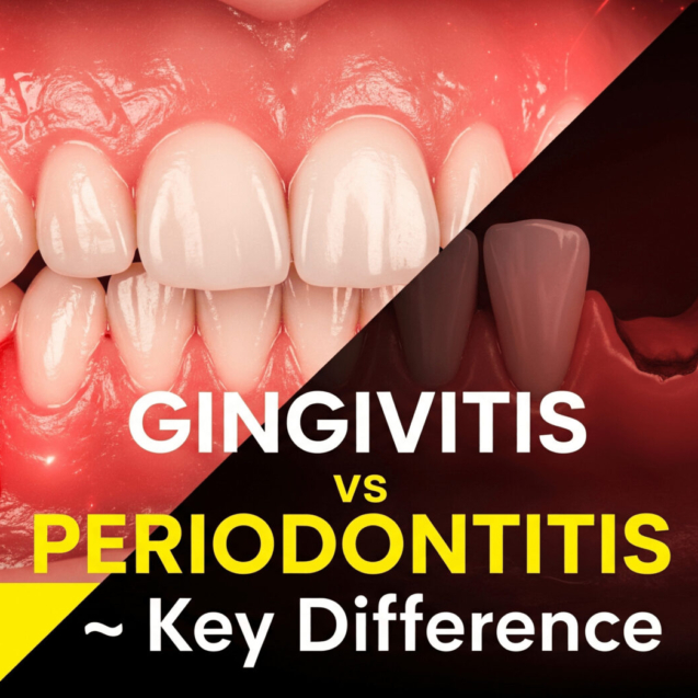 gingivitis vs periodontitis