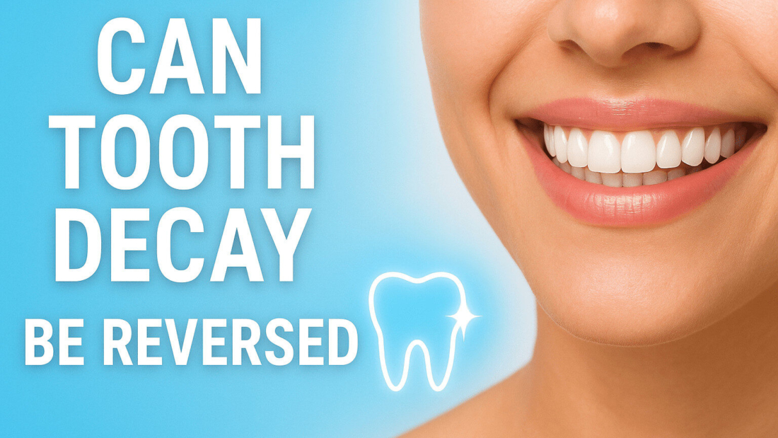 can tooth decay be reversed