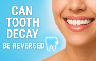 can tooth decay be reversed