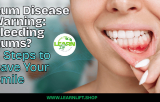 Gum Disease